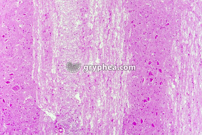 Moelle épinière CL niveau cornes antérieures x25 - gryphea.com